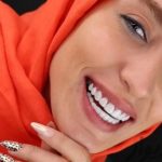 کامپوزیت زیبای دندان